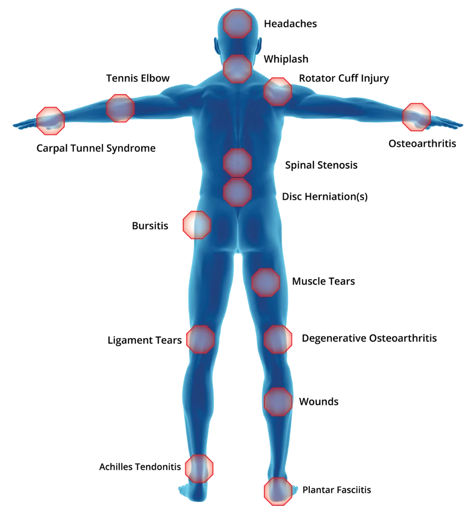 Laser Therapy Applications