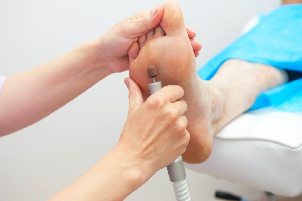 custom orthotics assessment Durham Region — foot care chiropody Courtice Pickering
